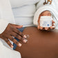 Stretch Mark Prevention Cream